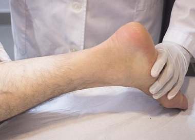 Causes and Treatments of Varicose Veins