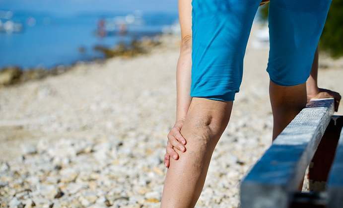 Creams Can Help Treat Varicose Veins